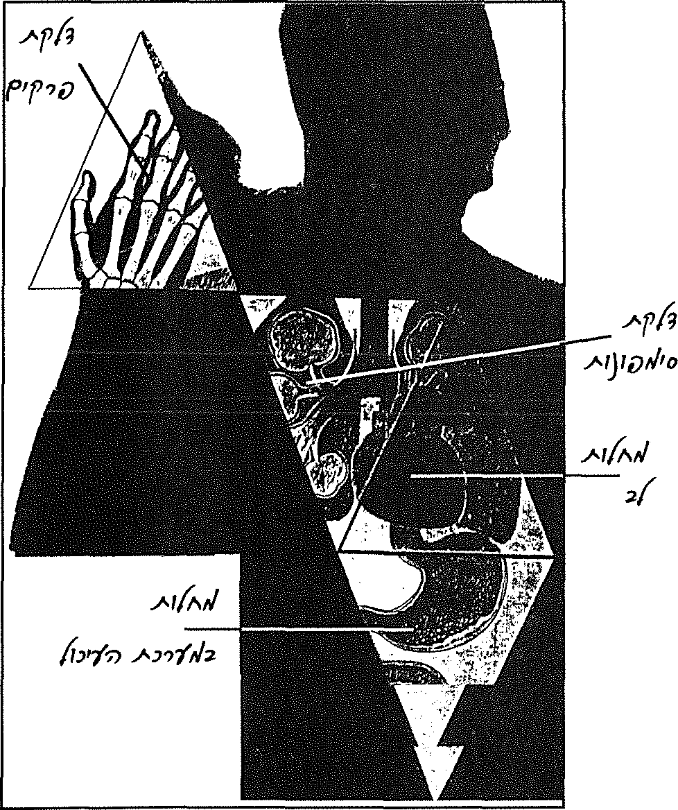 דלקת פרקים, דלקת סימפונות, מחלות לב,  מחלות במערכת העיכול